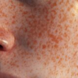 Creating Realistic Textures and Freckles with Tattoo Ink | Artistry Unleashed